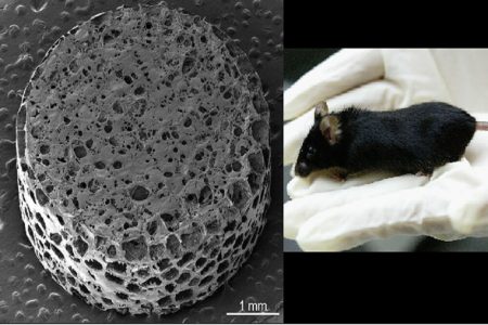 ایمپلنت اسفنجی راهی برای یافتن درمان‌ بهتر برای بیماری «MS»